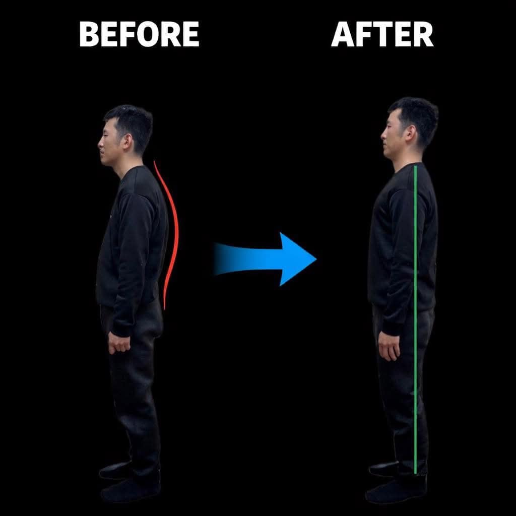 姿勢改善ビフォーアフター